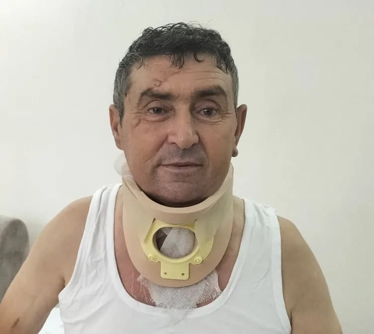 Antalya Hayvan Parkı'nda Kaçan Aslan Saldırısında Yaralanan Kişi: "Ben ve Aslan Suçsuzum"