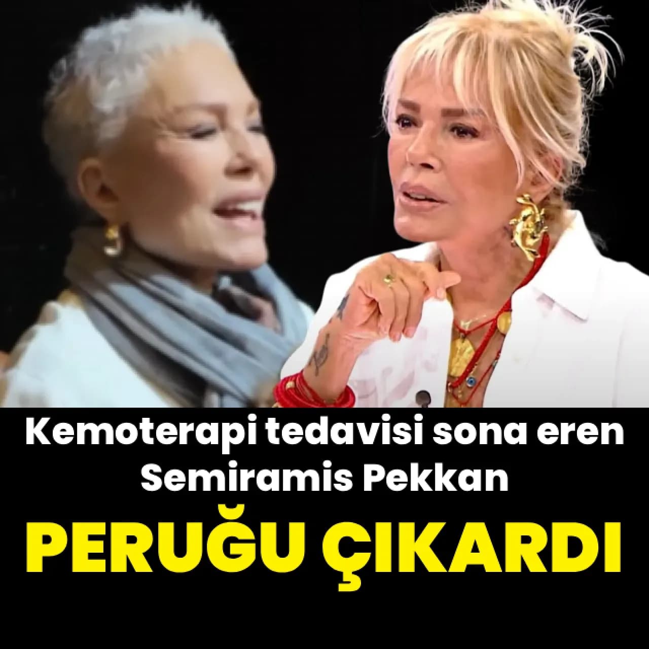 Semiramis Pekkan'ın Saçları Uzadı: Akciğer Kanseriyle Mücadelede Umut Veren Gelişme