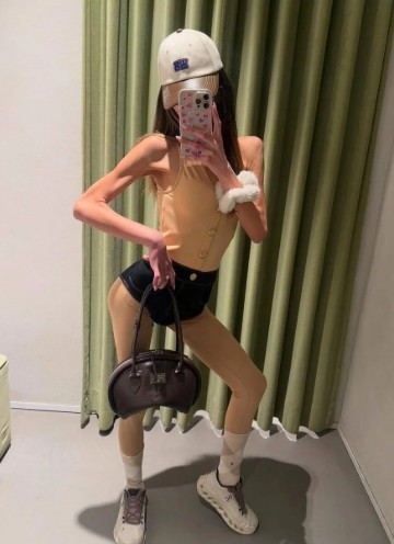 Nihal Candan'ın Yoğun Bakımdan İlk Görüntüsü Ortaya Çıktı: Sağlık Durumu Ciddi