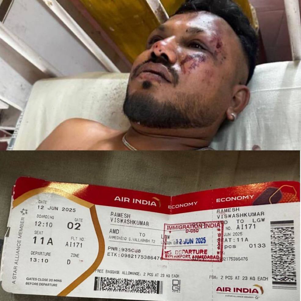 Hindistan'daki Uçak Kazasında Tek Hayatta Kalan: Viswashkumar Ramesh