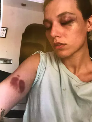 Ozan Güven'e Deniz Bulutsuz'a Şiddet Davasında Ceza