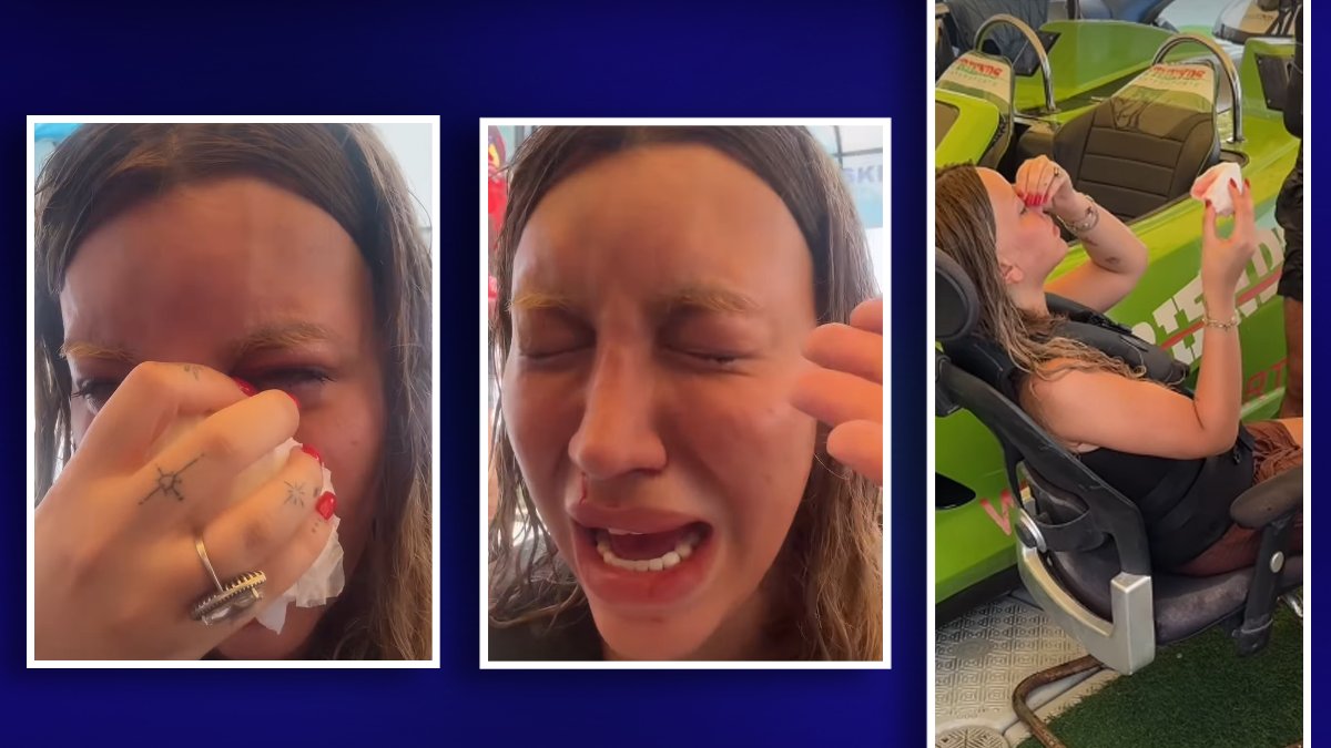 Dubai'de Kaza Geçiren Mika Raun'un Ameliyat Sonrası İlk Görüntüleri