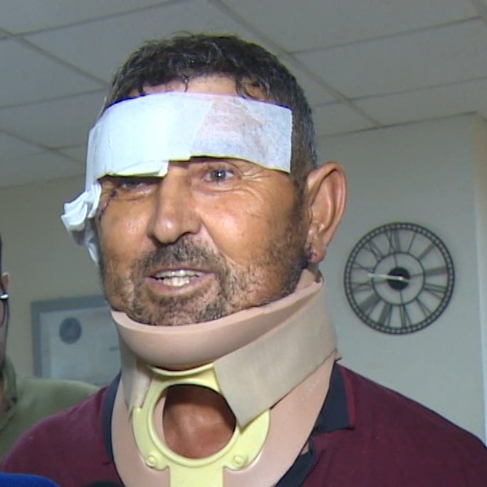 Aslan Saldırısına Uğrayan Vatandaş: 