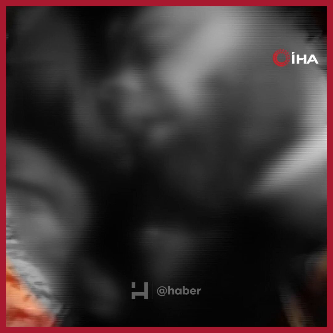 Ankara'da Evli Kadına Şok Saldırı: Eski Sevgilisinin Babası ve Ağabeyi Tarafından Darbedildi