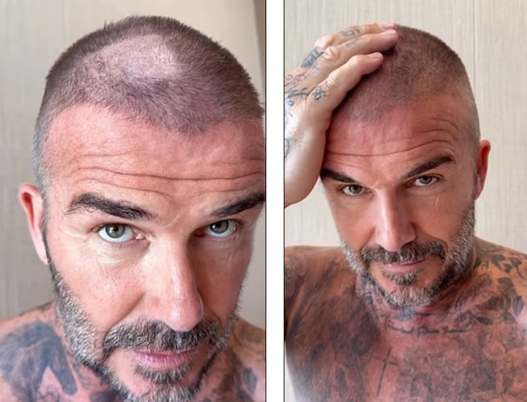 David Beckham Evde Saç Kesimi Sırasında Talihsiz Kaza Geçirdi